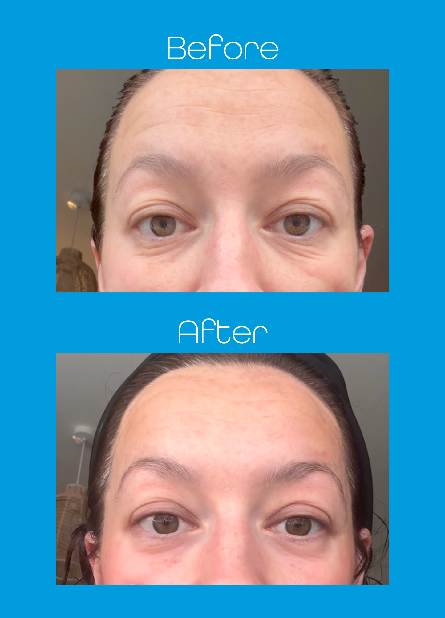 Liquid Collagen Stix